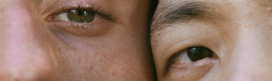 Problem Skin? Eczema + Sensitive Skin Care Tips